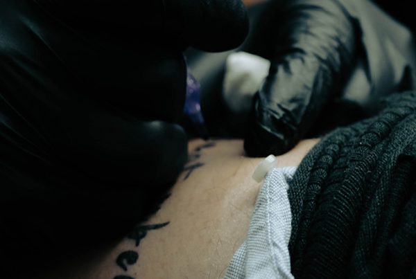 Dövme Derinin Hangi Katmanına Yapılır?